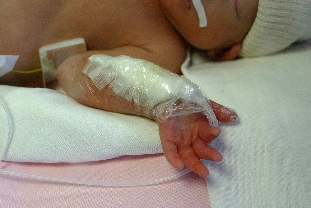 Assam: At Least 8 Infants Die In Hospital In 24 Hours, State Health Minister Say 'No Human Negligence'