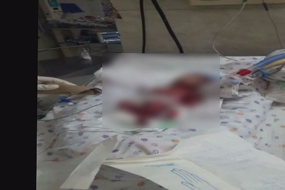 Max Hospital's Licence To Be Cancelled If Negligence Continues: Delhi Health Minister