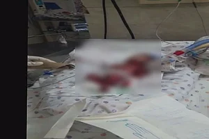 Max Hospital's Licence To Be Cancelled If Negligence Continues: Delhi Health Minister