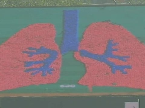 Over 5000 Students Set Guiness World Record By Forming Largest Human Image Of A Lung