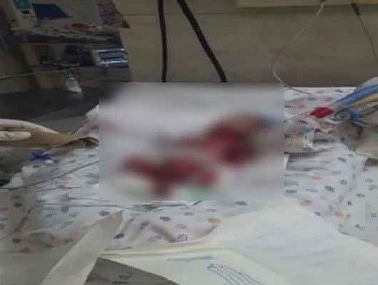 Delhi Hospital That Wrongly Declared Baby Dead,Terminates Services Of 2 Doctors Involved In The Case