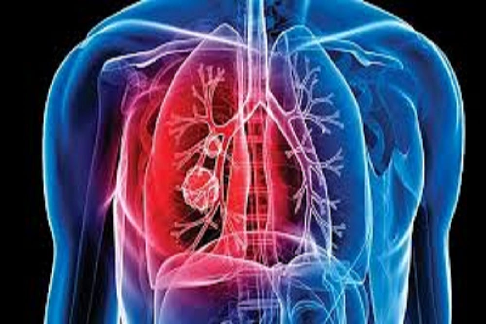 Arunachal Pradesh Governor volunteered to adopt two TB patients