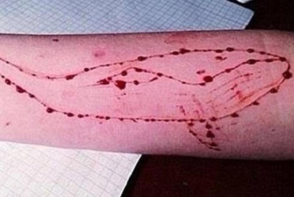 Government Directs Google, Facebook Among Others To Remove Blue Whale Challenge Links