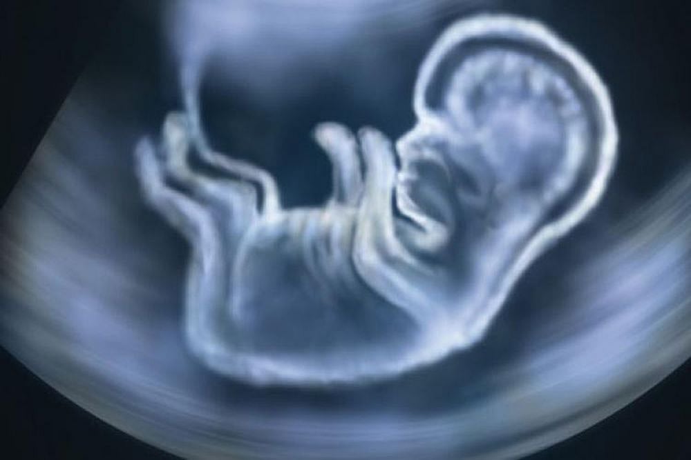 SC Allows Pune Woman To Abort Her 24-Week Foetus Without Skull