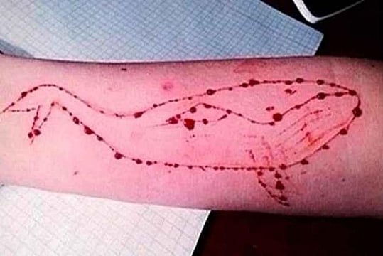 Jodhpur Girl With Blue Whale Carved Into Her Arm Jumps Into Lake At Midnight, Rescued