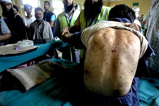 Amnesty International Launches Postcard Campaign, Calls For End To Use Of Pellet Guns In Kashmir