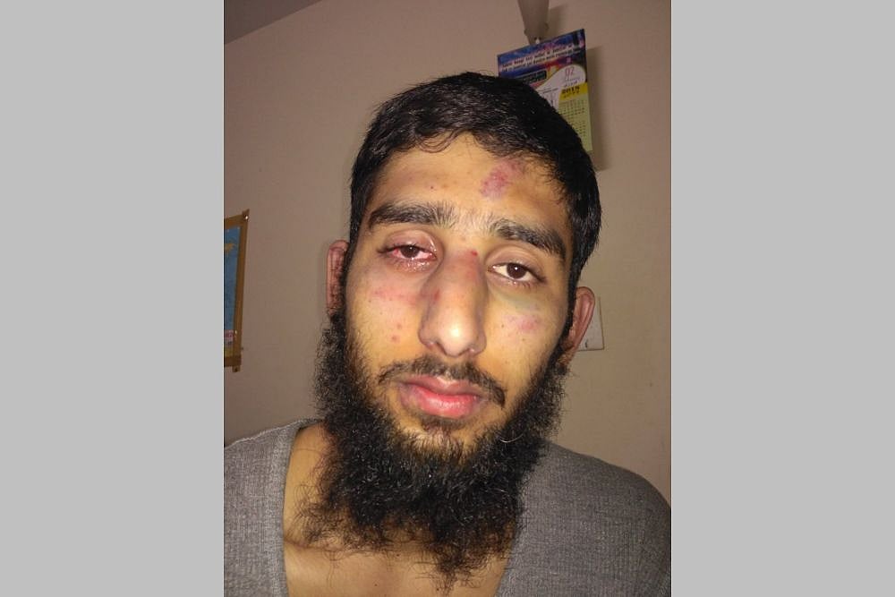 Kashmiri Students Allegedly Assaulted In Haryana, FIR Lodged