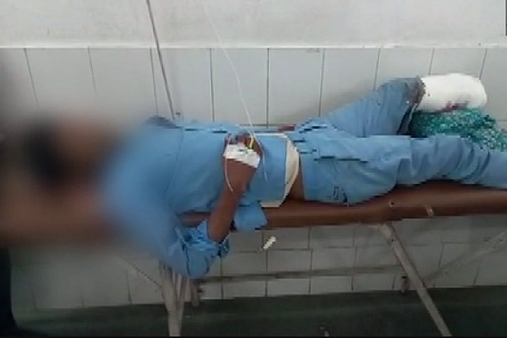 Patient's Amputated Leg Used As Pillow At Jhansi Govt Hospital In UP