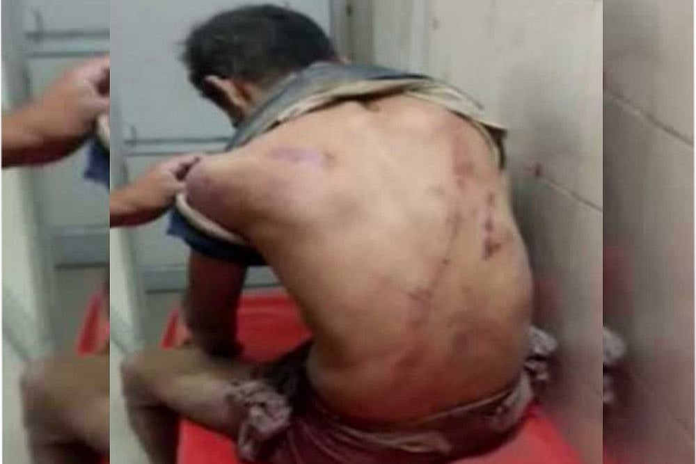 BJP MLA’s Brother Beat Me Up, Says Unnao Gangrape Victim’s Father On Video Hours Before He Died Of Injuries