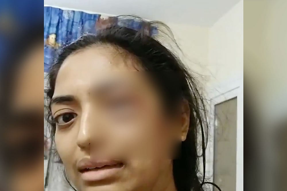 Indian Man Arrested In UAE After Wife Posts Video With Bleeding Eye Asking For Help