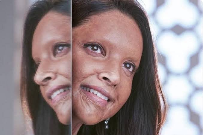 Bollywood star Deepika Padukone plays the lead role in Chhapaak, a real life movie based on acid attack survivor Laxmi Agrawal