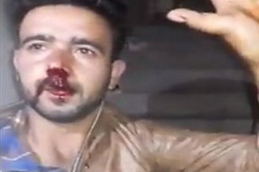 Pulwama Fallout: Kashmiri Shawl Vendor Thrashed In West Bengal's Nadia District