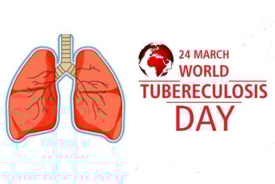 World Tuberculosis Day: Tuberculosis Is Treatable And Preventable, Say Experts