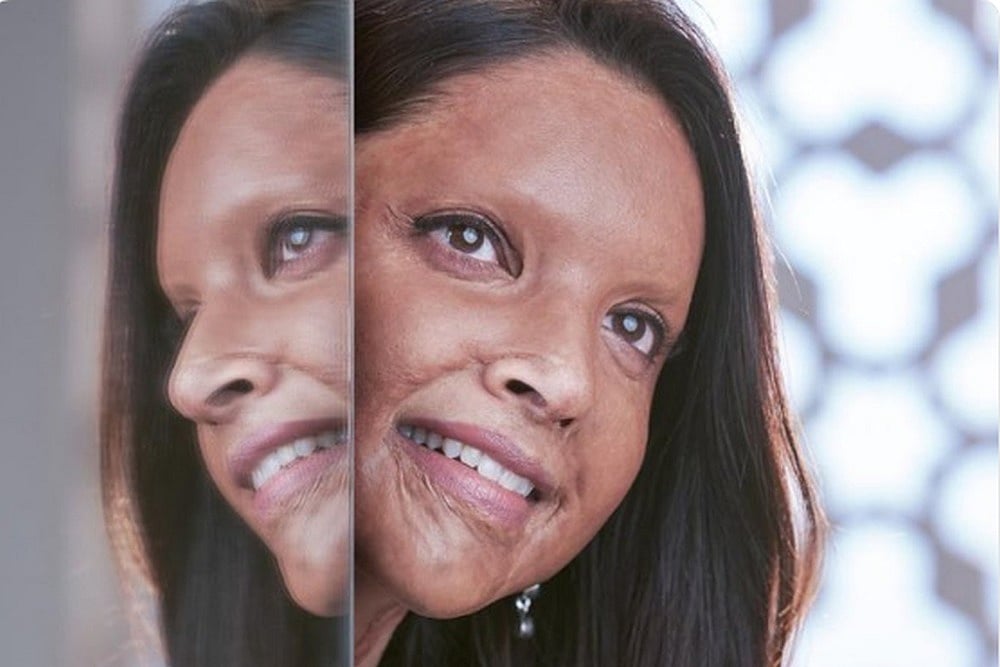 'Chhapaak': Deepika Padukone Will Be Seen Playing Real Life Acid Attack Survivor Laxmi Agarwal