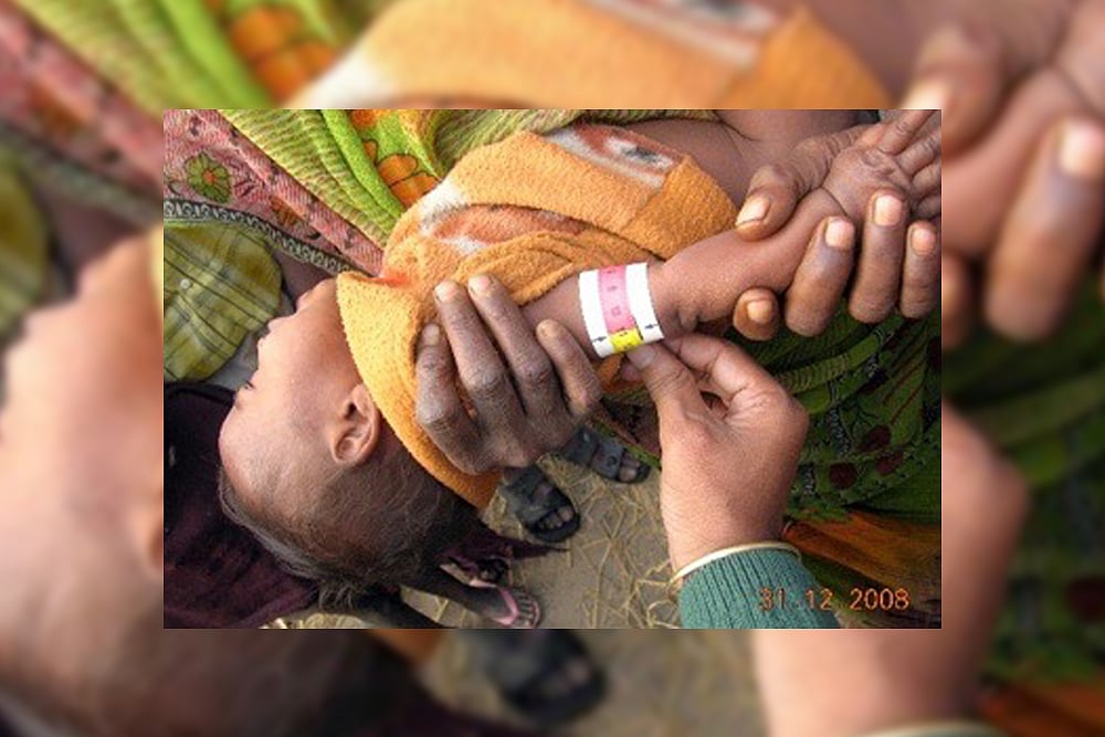 Madhepura, Measles, Musahars And Malnutrition