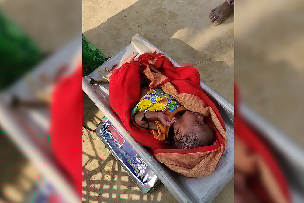 Overcoming Hurdles In Treating Varanasi's Malnourished Children