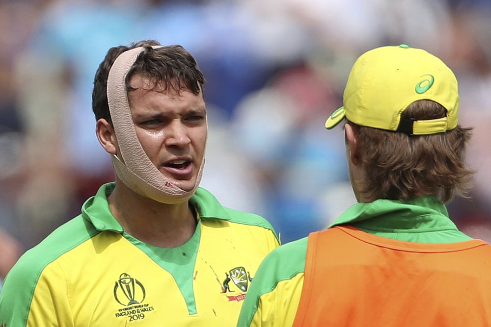 Cricket Australia Supports ICC's Concussion Substitutes Move