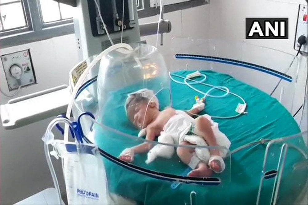 Haryana: Stray Dogs Save Baby Girl After Woman Dumped Her In Drain