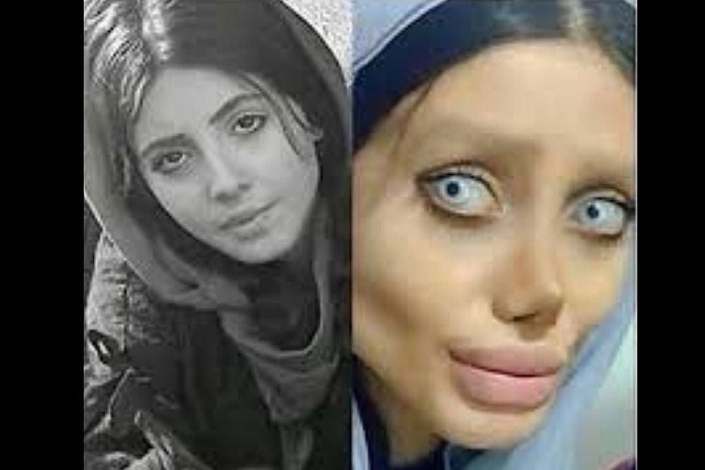 'Zombie Angelina Jolie' Jailed For 10 Years In Iran