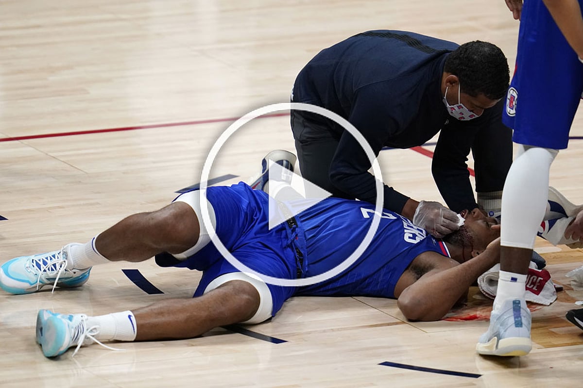 NBA: Kawhi Leonard Facial Injury 'Was Kind Of Scary' - VIDEO | Outlook India
