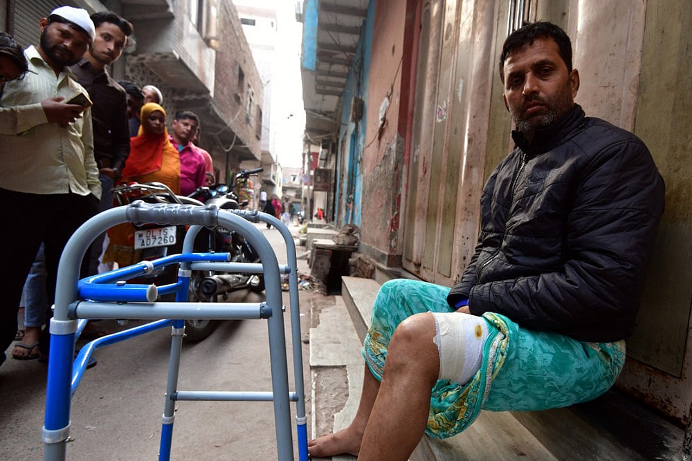 Delhi Riots: 'The Bullet That Hit Me Didn’t Have Any Religion'