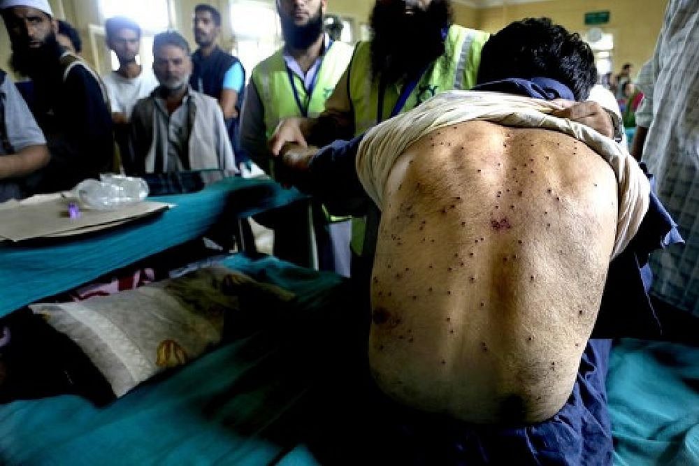 'As Long As There's Unruly Mob...': J&K HC Refuses To Ban Use Of Pellet Guns