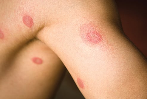 Treat Skin Related Problems At Home During Covid-19