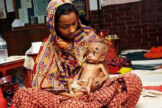 Fighting Severe Acute Malnutrition In India's Uttar Pradesh