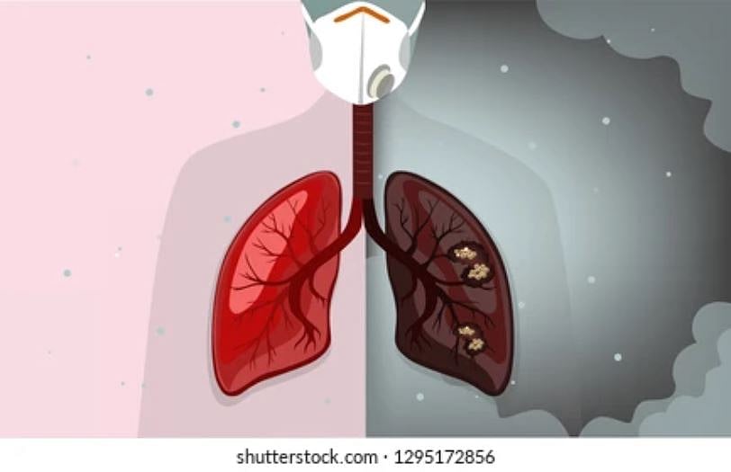 Delhi Air Pollution: Petitioner In HC Seeks 15 Lakh Damages, Matter Listed