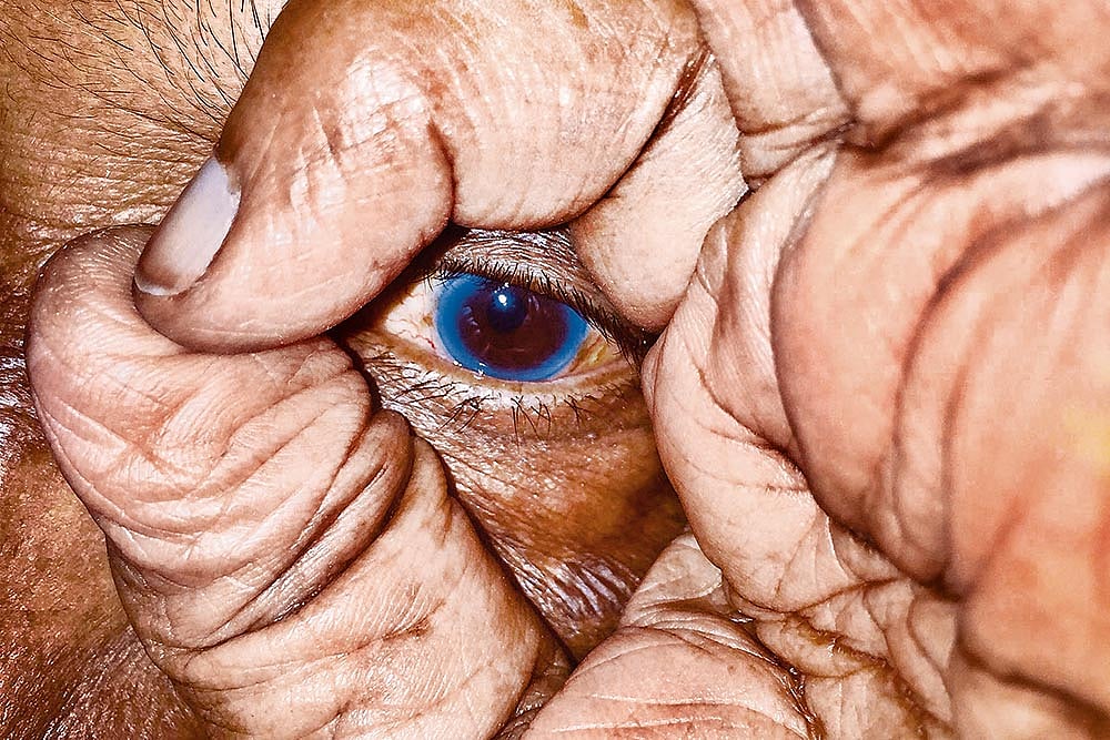 Pandemic Pangs: When The World Looked Inward For Succour