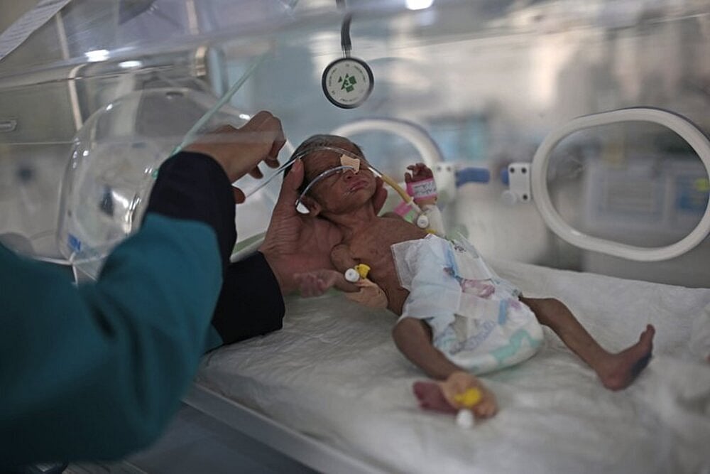 Over 2 Million Yemeni Children May Starve In 2021, 1 in 6 Children At Risk Of Death: UN
