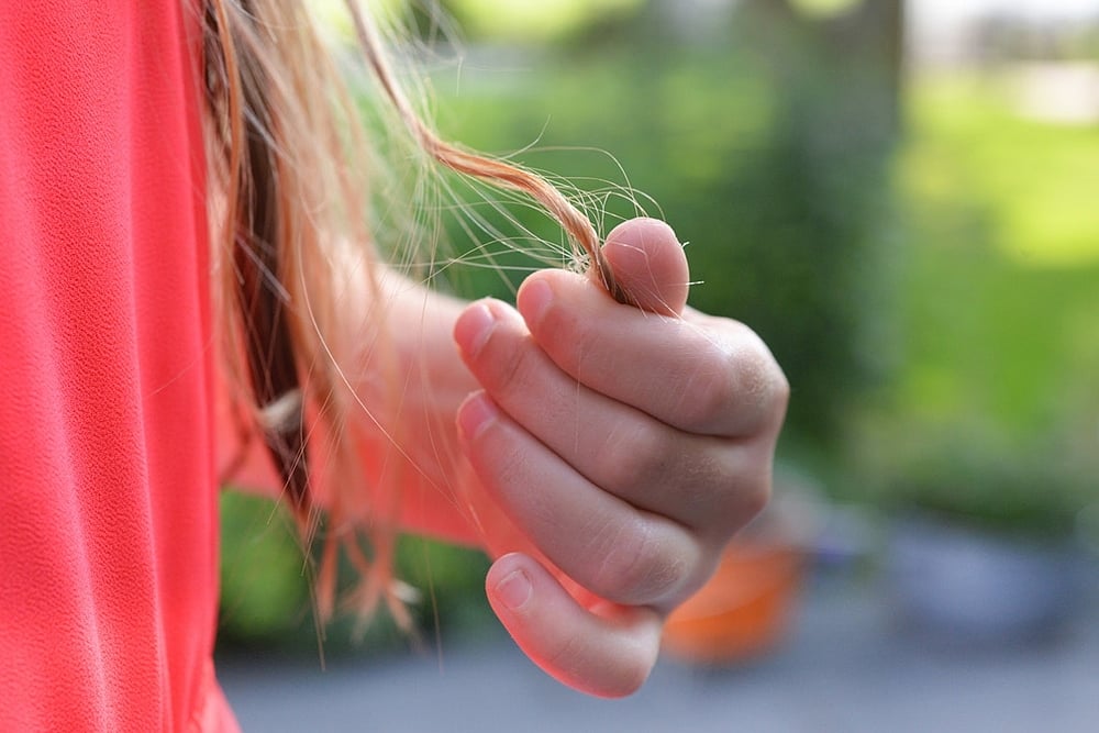 Girl Eating Her Own Hair Gets 48 Cm Long Hairball Removed From Stomach