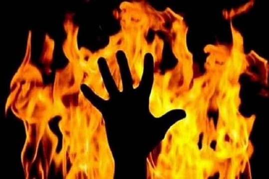 Sailor Abducted At Gunpoint Burnt Alive In Maharashtra, Succumbs To Injuries