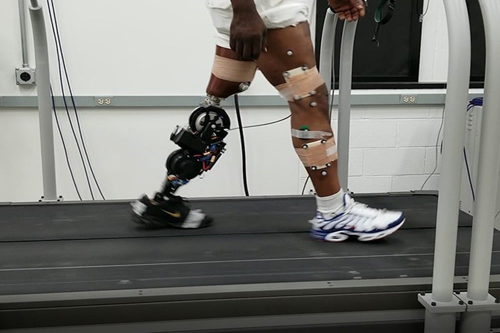 This Udaipur NGO Has Developed Prosthetics For Differently-Abled