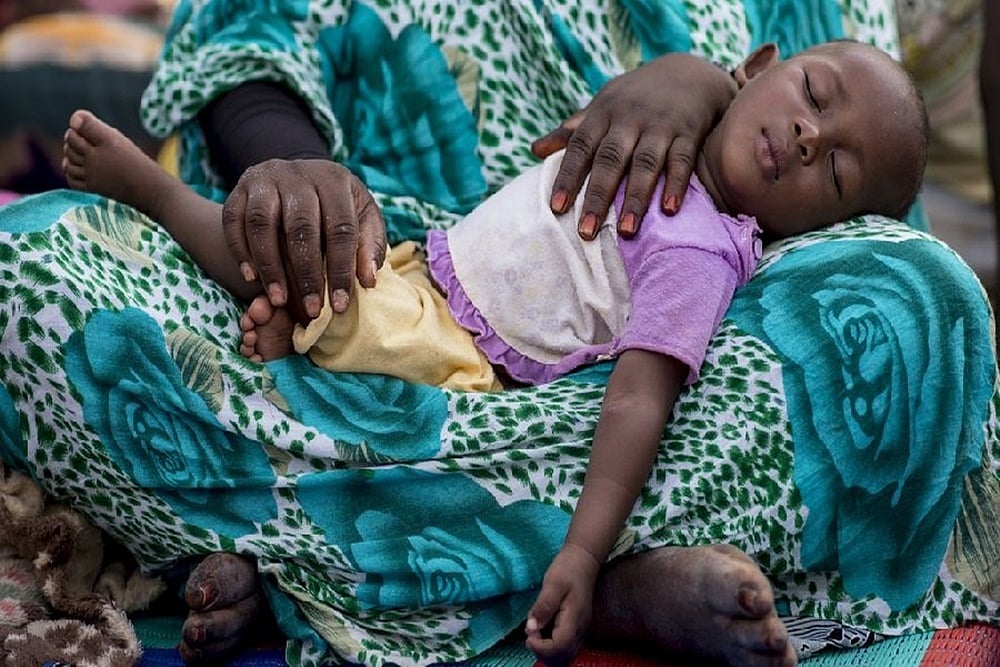 Why Breaking The Deadly Cycle Of Malnutrition Is Critical