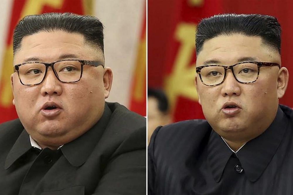 Is Kim Jong Un Healthy? The North Korean Leader’s Thinner Physique Triggers Speculations