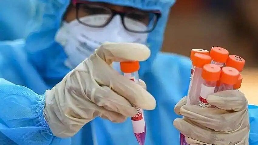 Seven Months Post Infection, SARS-CoV-2 Antibody Immunoglobulin G Either Remains Stable Or Increases: Study