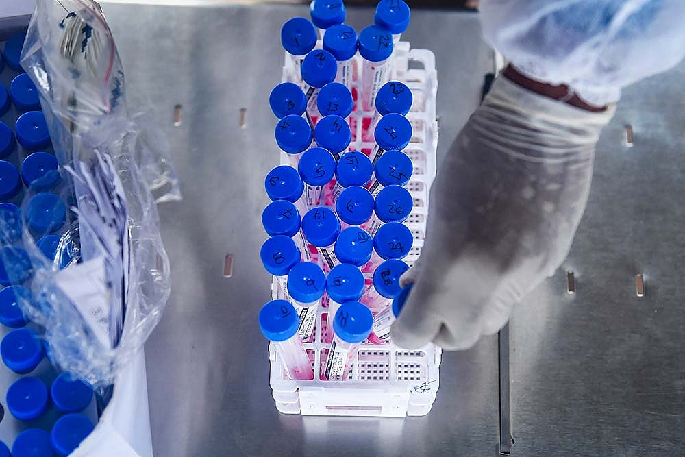 Many EDMC Councillors Test Covid Positive