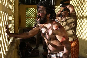 How Painful Is That Mottled Lattice Light