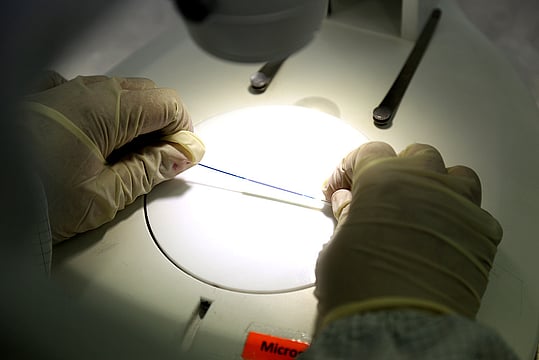 Cheaper Stents Make No Hearty Dent
