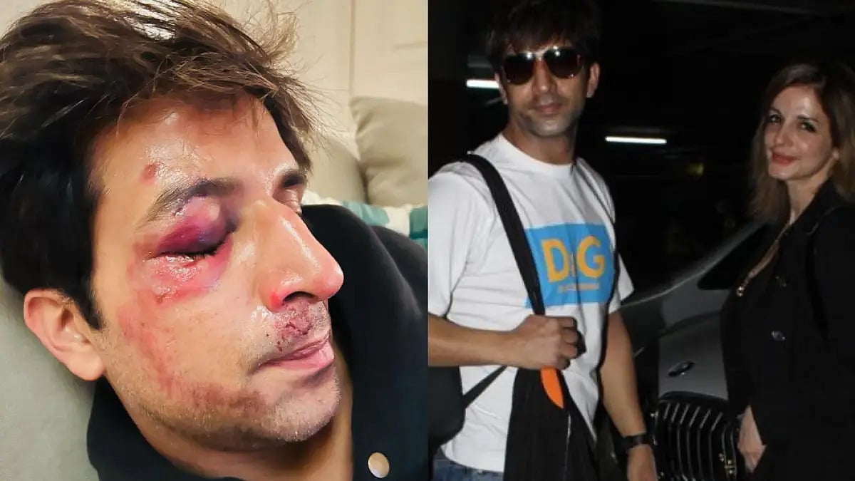 Arslan Goni And Sussanne Khan