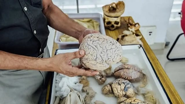 'Brain Health Clinic' Opened At Government Hospital In Bengaluru