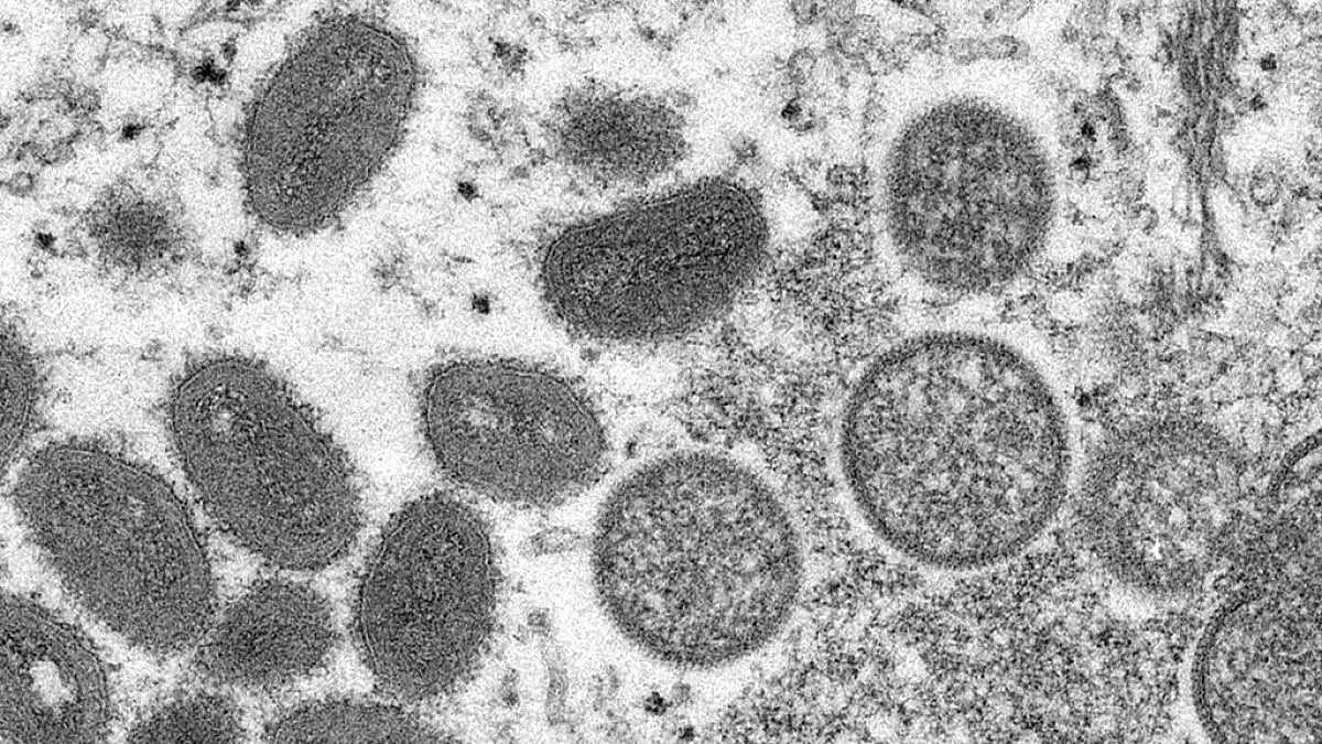  Oval-shaped monkeypox virions