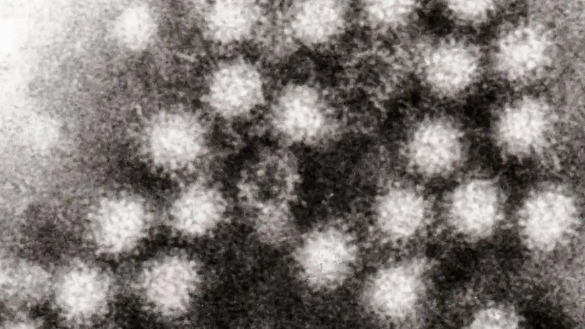 Norovirus Cases: Centre Asks Kerala State Surveillance Office To Submit Report