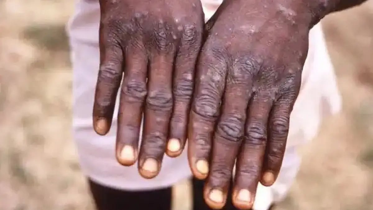 Representational Image