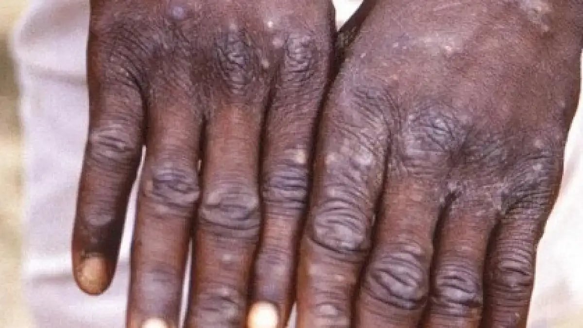 Representational Image