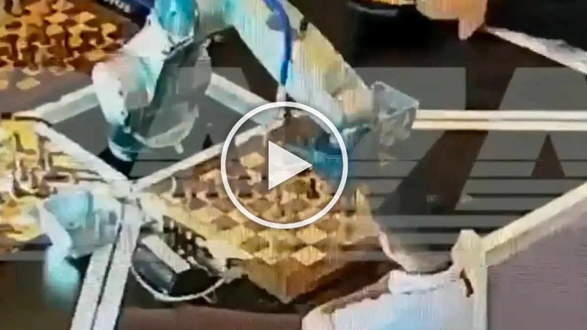 As the boy made his own move, the robot grabbed his finger.