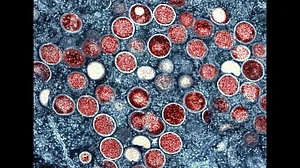 Monkeypox Virus Outbreak