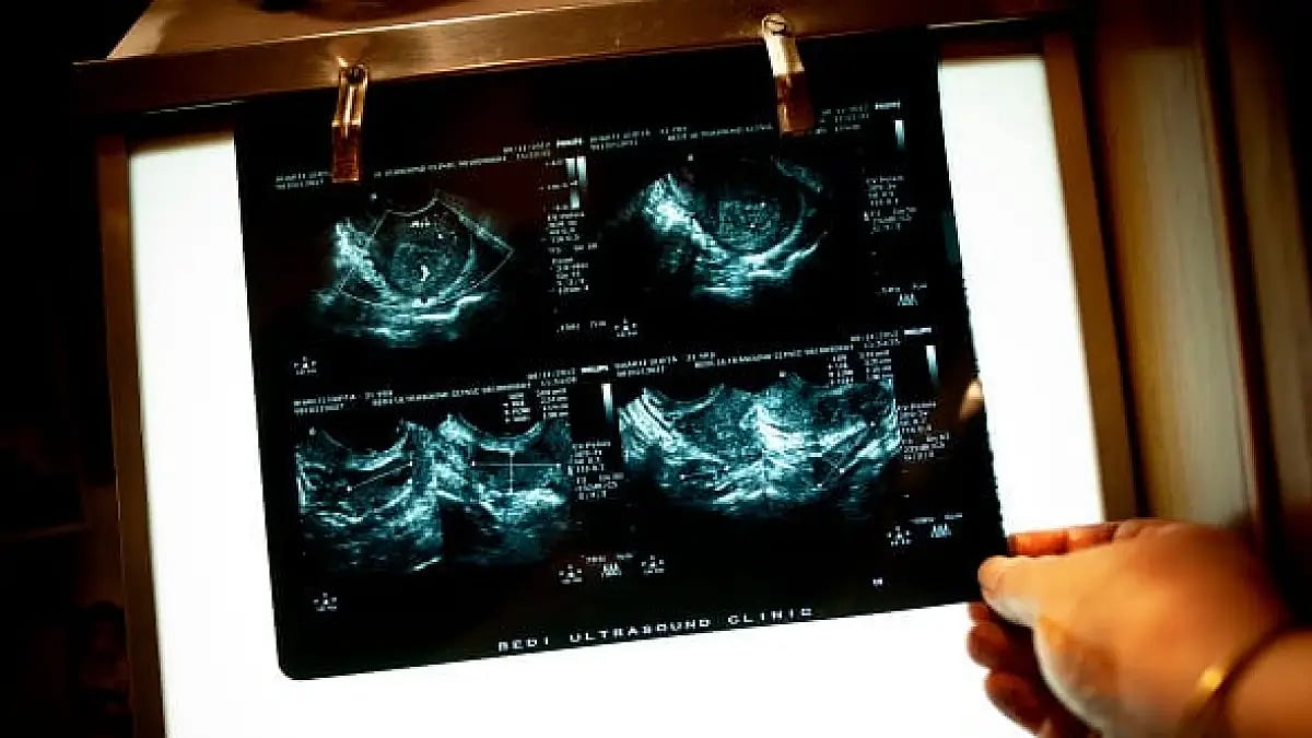 Gujarat HC allows minor to end pregnancy