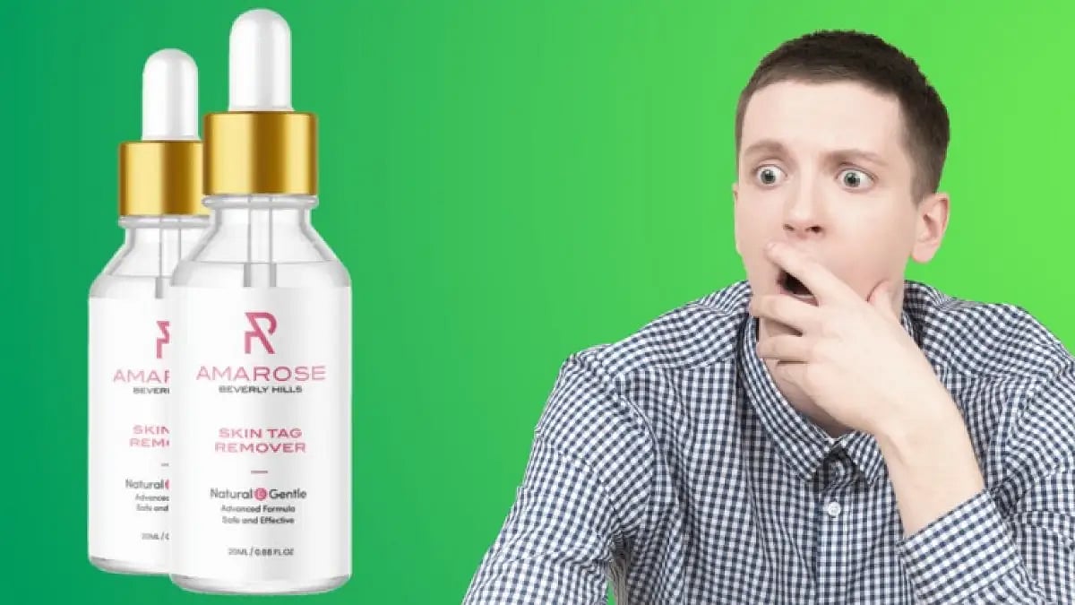 Amarose Skin Tag Remover